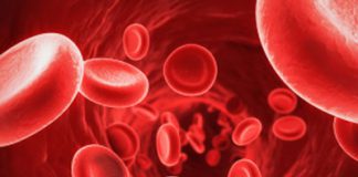 Blóðleysi, járnskortur, orsakir, einkenni og lausnir