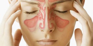 Ennisholubólga og kinnholubólga Ennisbólga og kinnholubólga